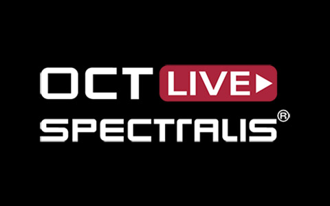 OCT Live SPECTRALIS