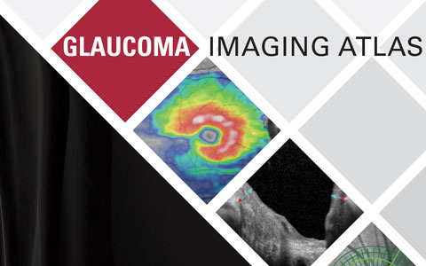 London Launch for World Class Glaucoma Atlas