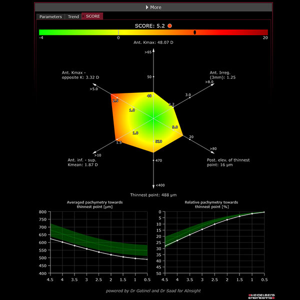 SCORE Analyzer